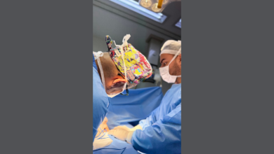 Dr. Gilberson Wanderley Silva orienta sobre os cuidados essenciais que garantem uma recuperação rápida e segura após a cirurgia.